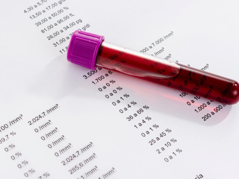 Hemograma Completo: Como Ler seu Exame e o que Significam os Resultados?