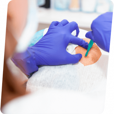 Biópsia em Centro Porto Alegre