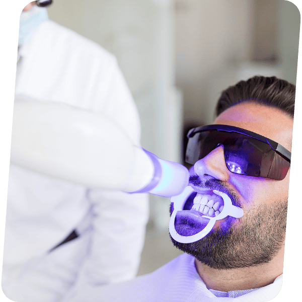 Clareamento Dental